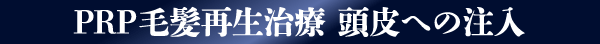 PRP毛髪再生治療 頭皮への注入